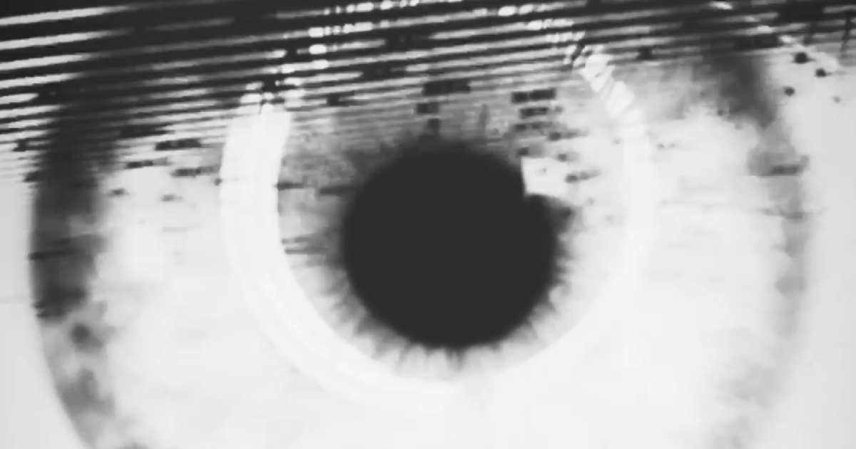 rma-eye